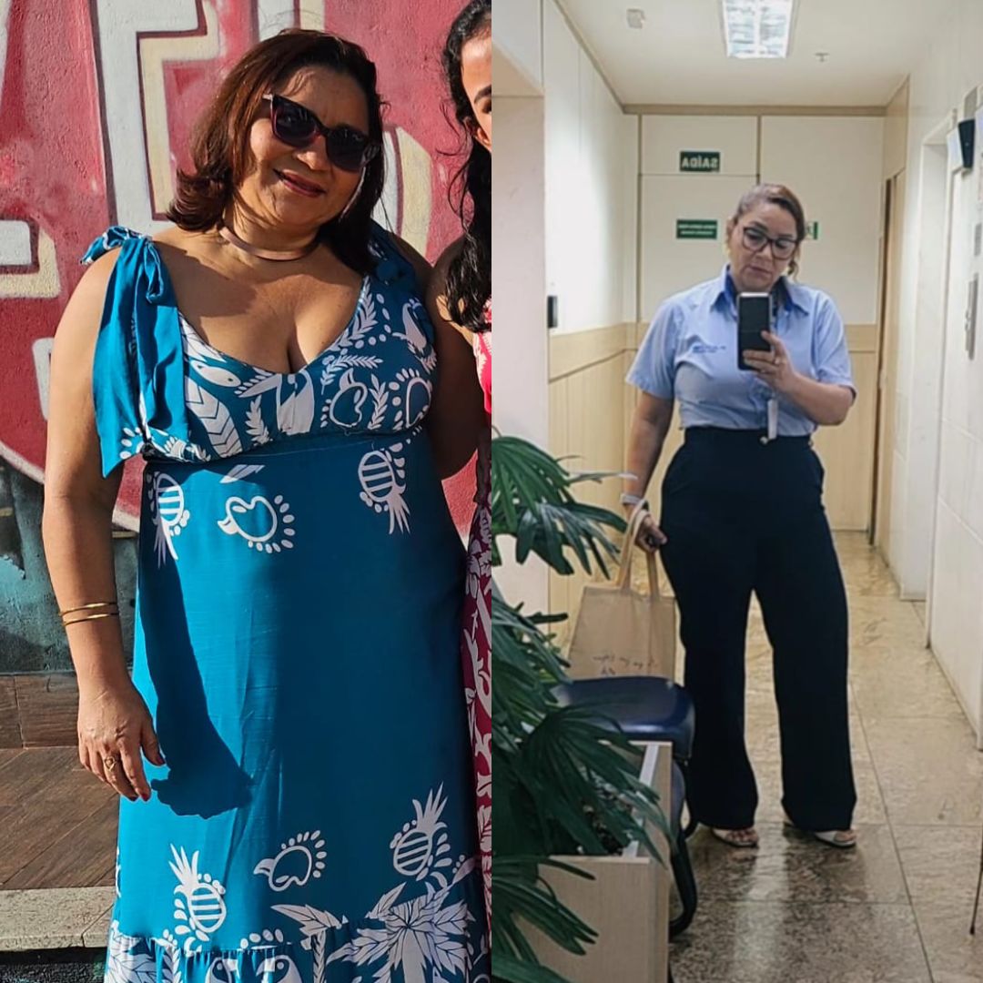 Comparativo antes e depois de uma aluna com redução de gordura corporal
